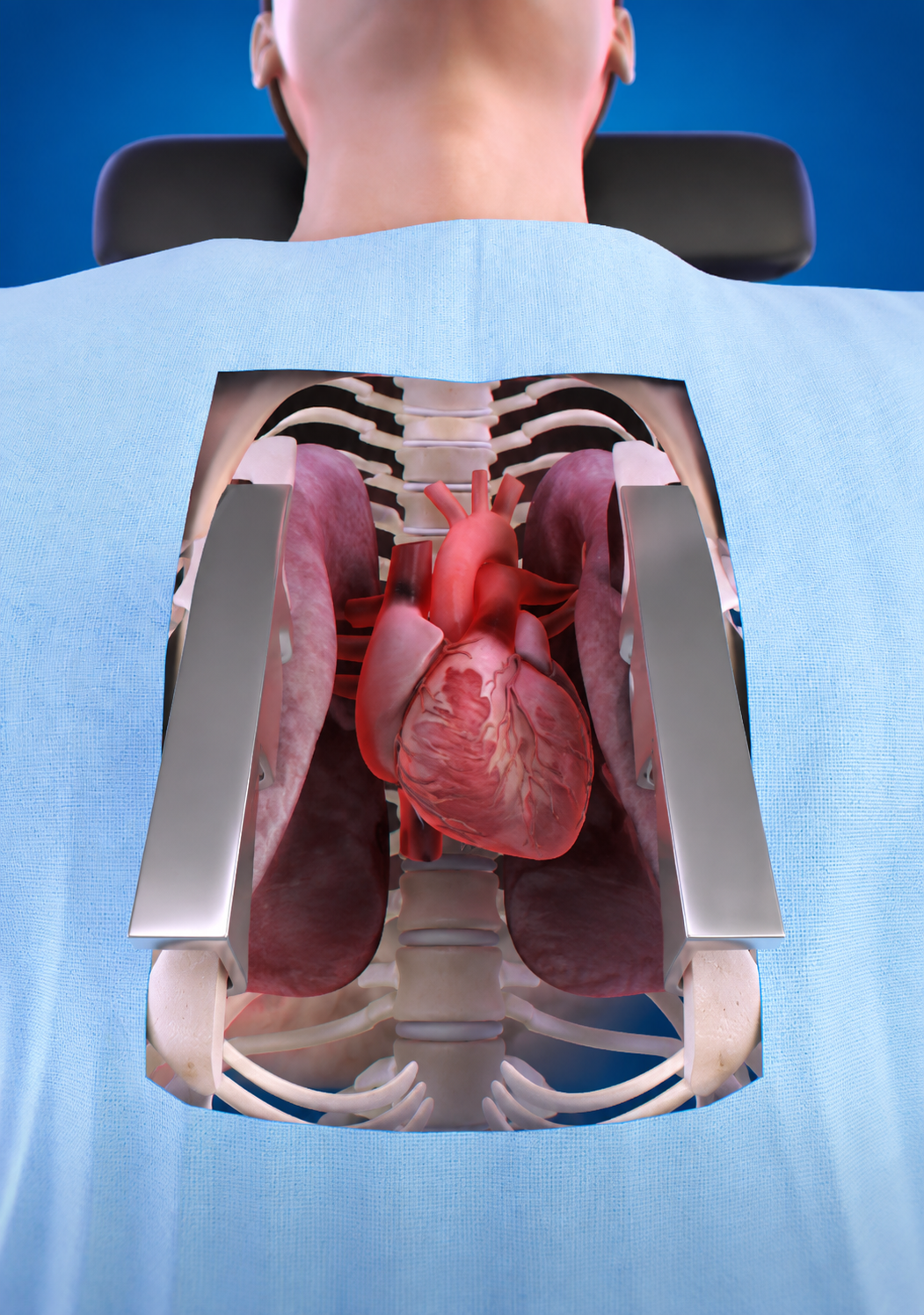 Chirurgie cardiaque
