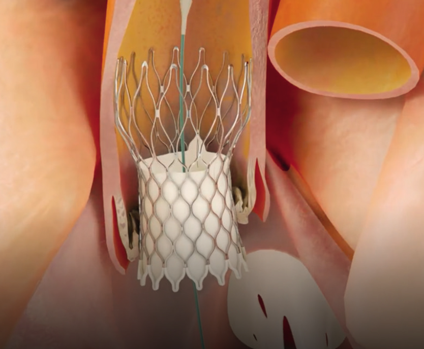 Cardiologie structurelle